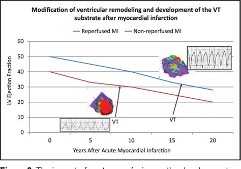 The Future of Arrhythmias and Electrophysiology.